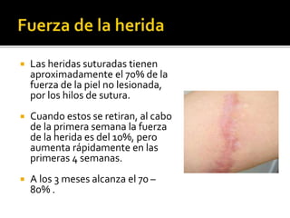  Las heridas suturadas tienen
aproximadamente el 70% de la
fuerza de la piel no lesionada,
por los hilos de sutura.
 Cuando estos se retiran, al cabo
de la primera semana la fuerza
de la herida es del 10%, pero
aumenta rápidamente en las
primeras 4 semanas.
 A los 3 meses alcanza el 70 –
80% .
 