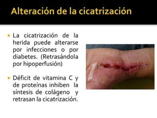  La cicatrización de la
herida puede alterarse
por infecciones o por
diabetes. (Retrasándola
por hipoperfusión)
 Déficit de vitamina C y
de proteínas inhiben la
síntesis de colágeno y
retrasan la cicatrización.
 
