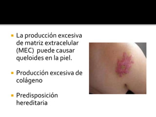  La producción excesiva
de matriz extracelular
(MEC) puede causar
queloides en la piel.
 Producción excesiva de
colágeno
 Predisposición
hereditaria
 