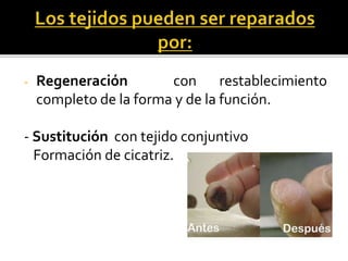 - Regeneración con restablecimiento
completo de la forma y de la función.
- Sustitución con tejido conjuntivo
Formación de cicatriz.
 