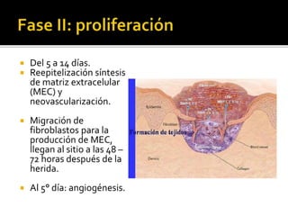  Del 5 a 14 días.
 Reepitelización síntesis
de matriz extracelular
(MEC) y
neovascularización.
 Migración de
fibroblastos para la
producción de MEC,
llegan al sitio a las 48 –
72 horas después de la
herida.
 Al 5° día: angiogénesis.
 