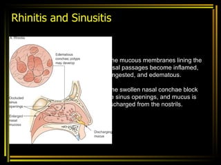 RESPIRATORY DISORDERS | PPT