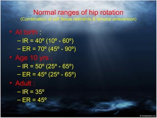 Rotational deformities of lower extremity in children | PPT