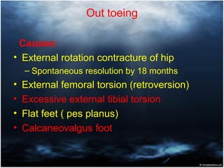 Rotational deformities of lower extremity in children | PPT