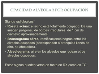 OPACIDAD ALVEOLAR POR OCUPACIÓN
Signos radiológicos
• Roseta acinar: el acino está totalmente ocupado. Da una
imagen poligonal, de bordes irregulares, de 1 cm de
diámetro aproximadamente.
• Broncograma aéreo: ramificaciones negras entre los
alveolos ocupados (corresponden a bronquios llenos de
aire, no afectados).
• Alveolograma: aire en los alveolos que rodean otros
alveolos ocupados.
Estos signos pueden verse en tanto en RX como en TC.
 