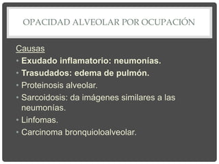 OPACIDAD ALVEOLAR POR OCUPACIÓN
Causas
• Exudado inflamatorio: neumonías.
• Trasudados: edema de pulmón.
• Proteinosis alveolar.
• Sarcoidosis: da imágenes similares a las
neumonías.
• Linfomas.
• Carcinoma bronquioloalveolar.
 