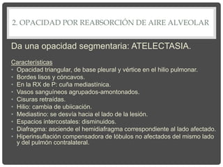 2. OPACIDAD POR REABSORCIÓN DE AIRE ALVEOLAR
Da una opacidad segmentaria: ATELECTASIA.
Características
• Opacidad triangular, de base pleural y vértice en el hilio pulmonar.
• Bordes lisos y cóncavos.
• En la RX de P: cuña mediastínica.
• Vasos sanguíneos agrupados-amontonados.
• Cisuras retraídas.
• Hilio: cambia de ubiicación.
• Mediastino: se desvía hacia el lado de la lesión.
• Espacios intercostales: disminuidos.
• Diafragma: asciende el hemidiafragma correspondiente al lado afectado.
• Hiperinsuflación compensadora de lóbulos no afectados del mismo lado
y del pulmón contralateral.
 