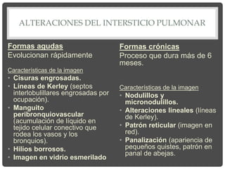 ALTERACIONES DEL INTERSTICIO PULMONAR
Formas agudas
Evolucionan rápidamente
Características de la imagen
• Cisuras engrosadas.
• Líneas de Kerley (septos
interlobulillares engrosadas por
ocupación).
• Manguito
peribronquiovascular
(acumulación de líquido en
tejido celular conectivo que
rodea los vasos y los
bronquios).
• Hilios borrosos.
• Imagen en vidrio esmerilado
Formas crónicas
Proceso que dura más de 6
meses.
Características de la imagen
• Nodulillos y
micronodulillos.
• Alteraciones lineales (líneas
de Kerley).
• Patrón reticular (imagen en
red).
• Panalización (apariencia de
pequeños quistes, patrón en
panal de abejas.
 