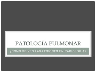 PATOLOGÍA PULMONAR
¿CÓMO SE VEN LAS LESIONES EN RADIOLOGÍA?
 