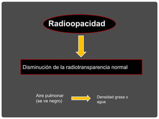 Radioopacidad
Disminución de la radiotransparencia normal
Aire pulmonar
(se ve negro)
Densidad grasa o
agua
 