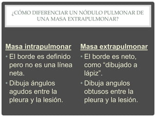 ¿CÓMO DIFERENCIAR UN NÓDULO PULMONAR DE
UNA MASA EXTRAPULMONAR?
Masa intrapulmonar
• El borde es definido
pero no es una línea
neta.
• Dibuja ángulos
agudos entre la
pleura y la lesión.
Masa extrapulmonar
• El borde es neto,
como “dibujado a
lápiz”.
• Dibuja angulos
obtusos entre la
pleura y la lesión.
 