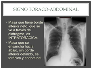 SIGNO TORACO-ABDOMINAL
• Masa que tiene borde
inferior neto, que se
ve a través de
diafragma, es
INTRATORÁCICA.
• Masa que se
ensancha hacia
abajo, sin borde
inferior definido, es
torácica y abdominal.
 