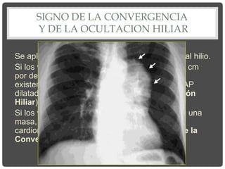 SIGNO DE LA CONVERGENCIA
Y DE LA OCULTACION HILIAR
Se aplica cuando existe una opacidad cercana al hilio.
Si los vasos pulmonares convergen a más de 1 cm
por dentro del borde de la lesión, confirma la
existencia de un tumor o una masa y descarta AP
dilatada o cardiomegalia (Signo de la Ocultación
Hiliar).
Si los vasos pulmonares convergen al borde de una
masa, indica la presencia de una AP dilatada o
cardiomegalia, descartando un tumor (Signo de la
Convergencia hiliar).
 
