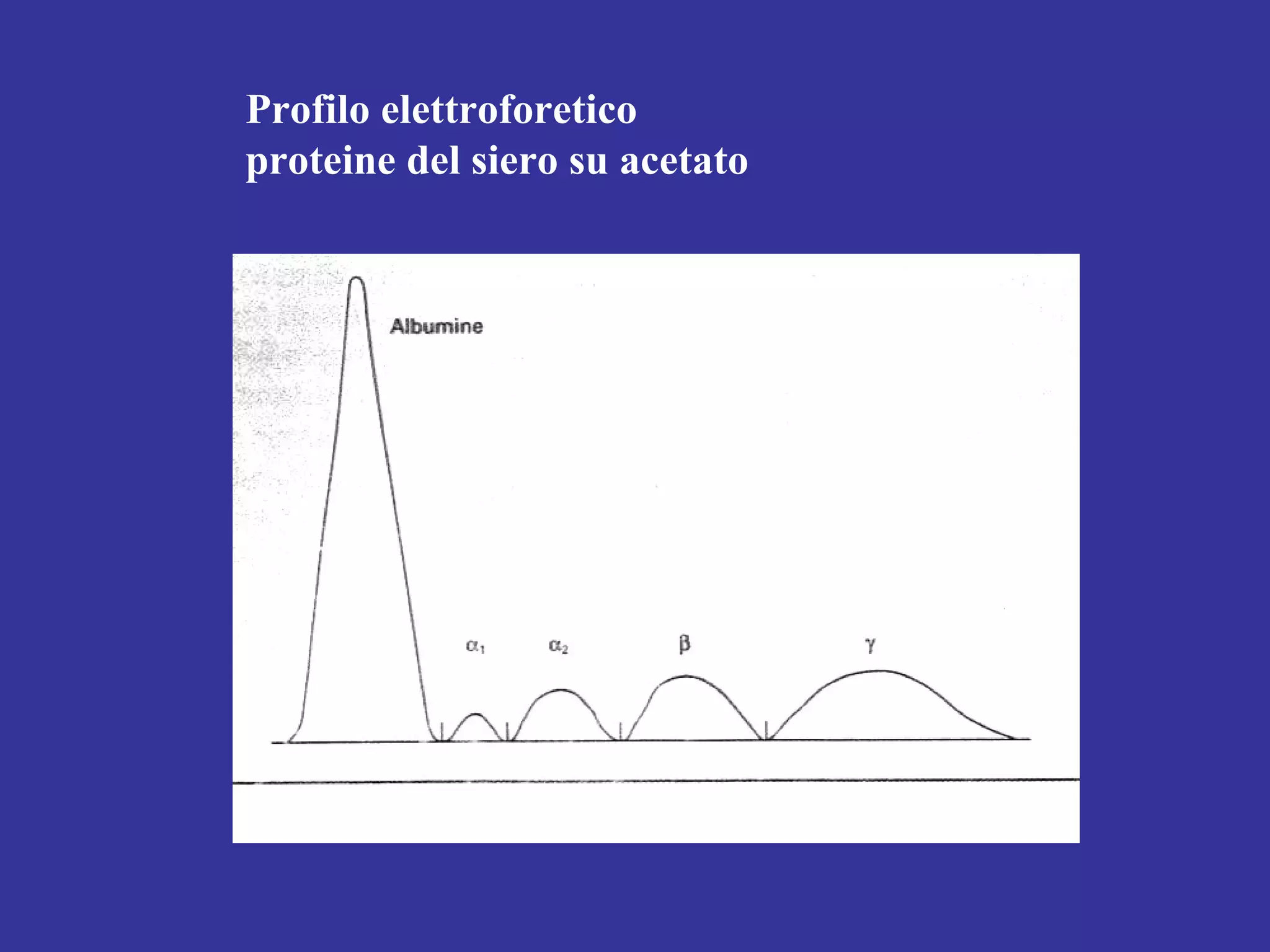 Profilo elettroforetico
proteine del siero su acetato
 