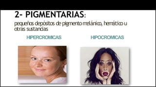 2- PIGMENTARIAS:
pequeñosdepósitos depigmentomelánico,hemáticou
otras sustancias
HIPERCROMICAS HIPOCROMICAS
 