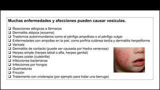 Muchas enfermedades y afecciones pueden causar vesículas.
 Reacciones alérgicas a fármacos
 Dermatitis atópica (eccema)
 Trastornos autoinmunitarios como el pénfigo ampolloso o el pénfigo vulgar
 Enfermedades con ampollas en la piel, como porfiria cutánea tardía y dermatitis herpetiforme
 Varicela
 Dermatitis de contacto (puede ser causada por hiedra venenosa)
 Herpes simple (herpes labial o afta, herpes genital)
 Herpes zoster (culebrilla)
 Infecciones bacterianas
 Infecciones por hongos
 Quemaduras
 Fricción
 Tratamiento con crioterapia (por ejemplo para tratar una berruga)
 