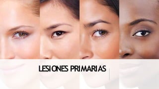 LESIONES PRIMARIAS
 