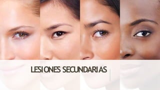 LESIONES SECUNDARIAS
 