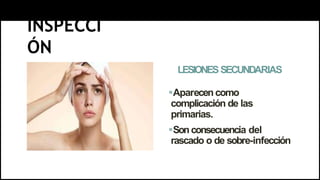 INSPECCI
ÓN
LESIONESSECUNDARIAS
Aparecen como
complicación de las
primarias.
Sonconsecuencia del
rascado o de sobre-infección
 