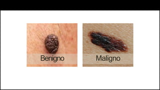 Benigno Maligno
 