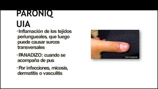 PARONIQ
UIA
Inflamación de los tejidos
periungueales, que luego
puede causar surcos
transversales
P
ANADIZO: cuando se
acompaña de pus
Por infecciones, micosis,
dermatitis o vasculitis
 