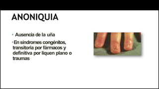 ANONIQUIA
 Ausencia de la uña
Ensíndromes congénitos,
transitoria por fármacos y
definitiva por liquen plano o
traumas
 