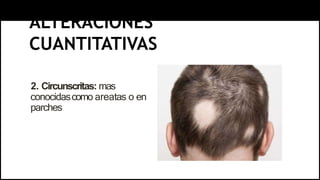 ALTERACIONES
CUANTITATIVAS
2. Circunscritas: mas
conocidascomo areatas o en
parches
 