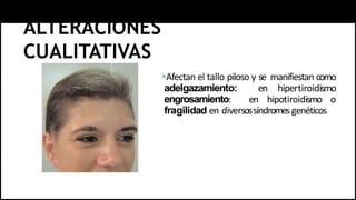 ALTERACIONES
CUALITATIVAS
Afectan el tallo piloso y se manifiestan como
adelgazamiento: en hipertiroidismo
engrosamiento: en hipotiroidismo o
fragilidad en diversossíndromesgenéticos
 