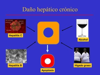 Daño hepático crónico



Hepatitis C
                                      Alcohol




Hepatitis B                      Hígado graso
                     Apoptosis
 
