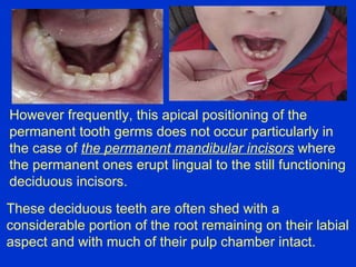 3 shedding future | PPT