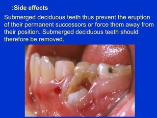3 shedding future | PPT