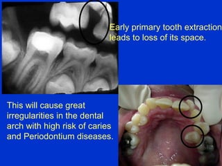 3 shedding future | PPT