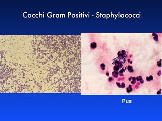 Cocchi Gram Positivi - Staphylococci Pus   
