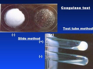 Coagulase test Slide method Test tube method (+) (-) (-)  (+) 