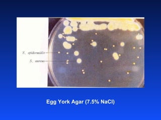 Egg York Agar (7.5% NaCl) 