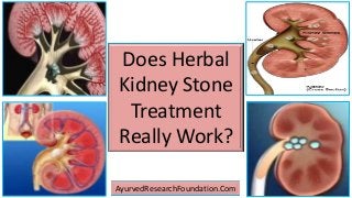 Does Herbal
Kidney Stone
Treatment
Really Work?
AyurvedResearchFoundation.Com
 