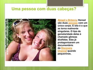 Uma pessoa com duas cabeças?
Abigail e Britanny Hensel
são duas pessoas com um
único corpo. E isto é o que
as torna realmente
singulares. O tipo de
gemelaridade delas é
chamado gêmeas
dicéfalas. Elas já
protagonizaram um
documentário
do Discovery
Channel quando
pequeninas.
 