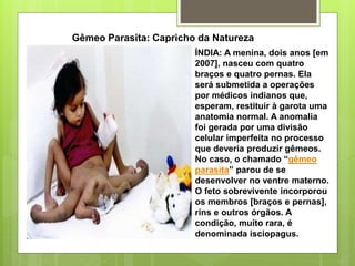 Gêmeo Parasita: Capricho da Natureza
ÍNDIA: A menina, dois anos [em
2007], nasceu com quatro
braços e quatro pernas. Ela
será submetida a operações
por médicos indianos que,
esperam, restituir à garota uma
anatomia normal. A anomalia
foi gerada por uma divisão
celular imperfeita no processo
que deveria produzir gêmeos.
No caso, o chamado “gêmeo
parasita” parou de se
desenvolver no ventre materno.
O feto sobrevivente incorporou
os membros [braços e pernas],
rins e outros órgãos. A
condição, muito rara, é
denominada isciopagus.
 