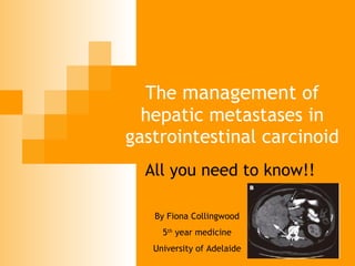 The  management  of hepatic metastases in gastrointestinal carcinoid All you need to know!! By Fiona Collingwood 5 th  year medicine University of Adelaide 