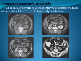 Presentation on urological dialysis and j | PDF