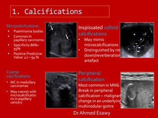 thyriod gland imaging part 3 (benign malignant thyriod nodule) Dr Ahmed ...