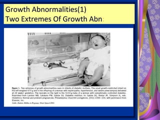 Growth Abnormalities(1)
Two Extremes Of Growth Abn:
 