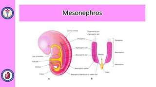 Mesonephros
 