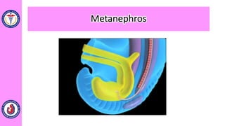 Metanephros
 