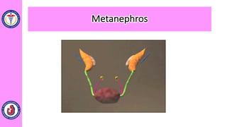 Metanephros
 