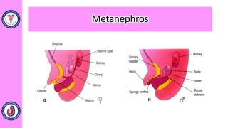 Metanephros
 