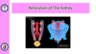 Relocation of The Kidney
 