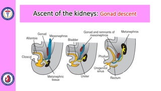 Ascent of the kidneys: Gonad descent
 