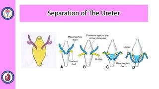 Separation of The Ureter
 