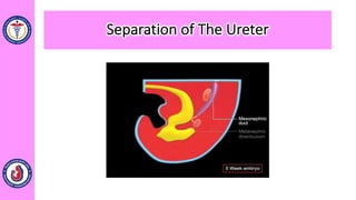 Separation of The Ureter
 